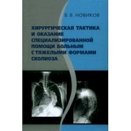 Хирургическая тактика и оказание специализированной помощи больным с тяжёлыми формами сколиоза