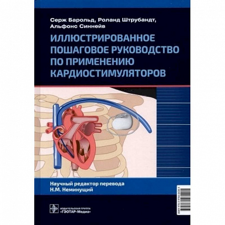 Фото Иллюстрированное пошаговое руководство по применению кардиостимуляторов