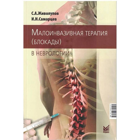 Фото Малоинвазивная терапия в неврологии