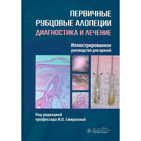 Фото Первичные рубцовые алопеции. Диагностика и лечение. Иллюстрированное руководство для врачей
