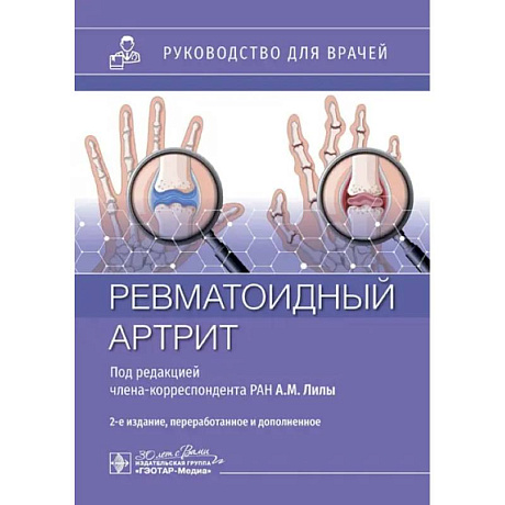Фото Ревматоидный артрит: руководство для врачей