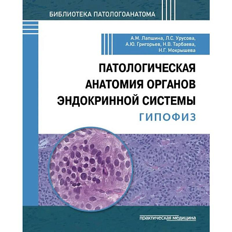 Фото Патологич анатомия органов эндокр системы. Гипофиз