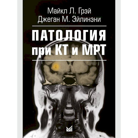 Фото Патология при КТ и МРТ