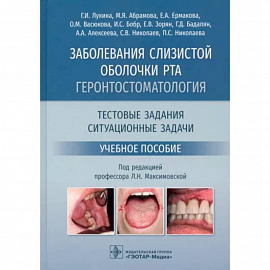 Заболевания слизистой оболочки рта. Геронтостоматология. Тестовые задания, ситуационные задачи