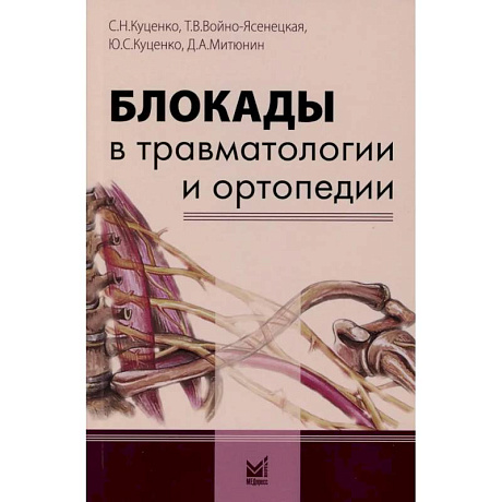 Фото Блокады в травматологии и ортопедии