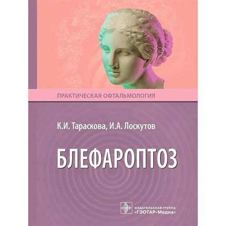 Фото Блефароптоз