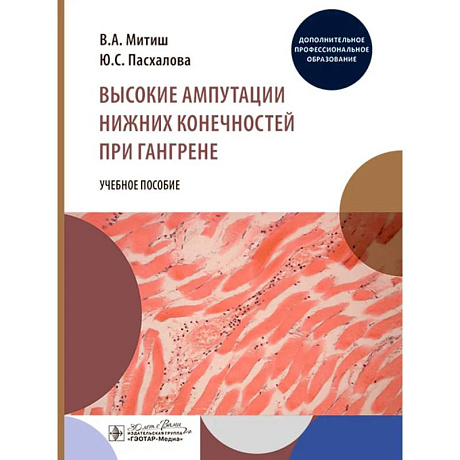 Фото Высокие ампутации нижних конечностей при гангрене