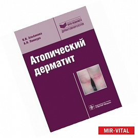 Атопический дерматит. Учебное пособие