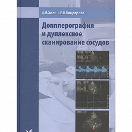 Допплерография и дуплексное сканирование сосудов. Холин