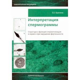 Интерпретация спермограммы. Структура и функция сперматозоидов в норме и при нарушении фертильности