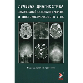 Лучевая диагностика заболеваний оснований черепа и мостмозжечкового угла