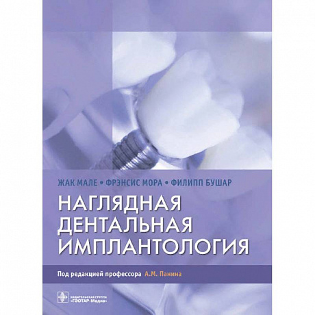 Фото Наглядная дентальная имплантология