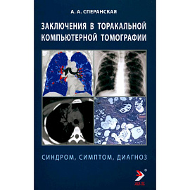 Заключение в таракальной компьютерной  томографии. Симптом, синдром, диагноз.