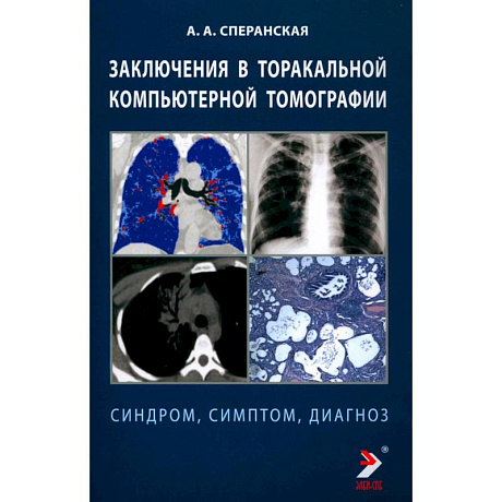 Фото Заключение в таракальной компьютерной  томографии. Симптом, синдром, диагноз.