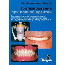 Протезирование при полной адентии. Клинические и зуботехнические этапы изготовления съемных полных протезов по модифицир