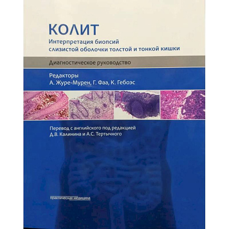 Фото Колит. Интерпретация биопсий слизистой оболочки толстой и тонкой кишки. Диагностическое руководство