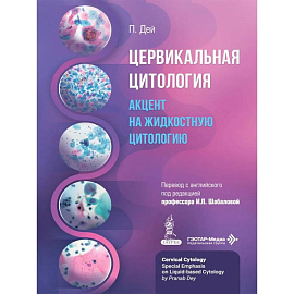 Цервикальная цитология. Акцент на жидкостную цитологию