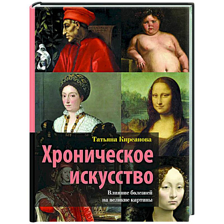 Фото Хроническое искусство. Влияние болезней на великие картины