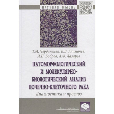 Фото Патоморфологический и молекулярно-биологический анализ почечно-клеточного рака. Диагностика и прогноз. Монография