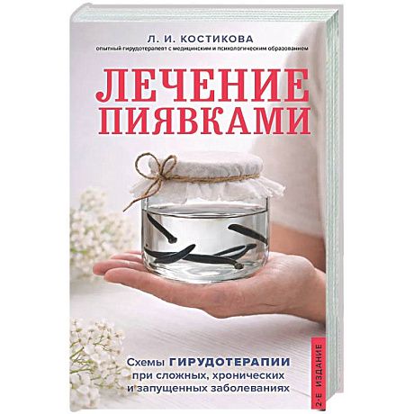 Фото Лечение пиявками. Схемы гирудотерапии при сложных, хронических и запущенных заболеваниях