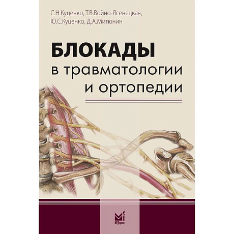 Фото Блокады в травматологии и ортопедии