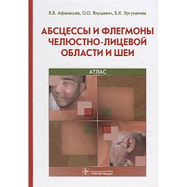 Абсцессы и флегмоны челюстно-лицевой области и шеи