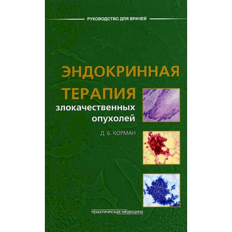Фото Эндокринная терапия злокачественных опухолей
