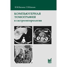 Компьютерная томография в гастроэнтерологии
