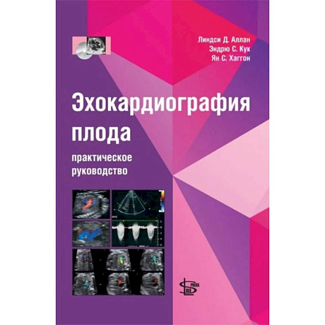 Фото Эхокардиография плода: практическое руководство. + DVD