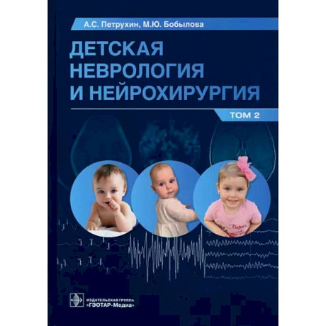 Фото Детская неврология и нейрохирургия. Учебник в 2 томах. Том 2