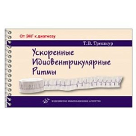 Ускоренные идиовентрикулярные ритмы: клинико-электрокардиографические особенности, систематизация по ЭКГ-характеристикам, дифференцирован