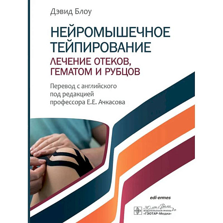 Фото Нейромышечное тейпирование. Лечение отеков, гематом и рубцов