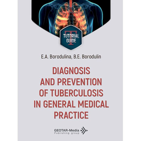Фото Diagnosis and prevention of tuberculosis in general medical practice = Диагностика и профилактика туберкулеза в общей врачебной практике